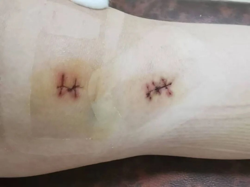 此文版权归, gtimg, 之前的准备 此文版权归, gtimg, 之前的准备